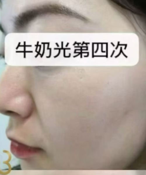 护理后