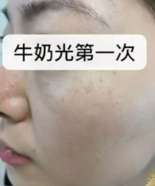 护理前